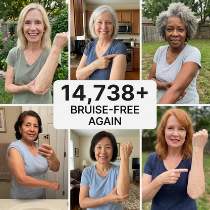 💥100K+ SOLD💕- 𝐏𝐮𝐫𝐞𝐥𝐨𝐫𝐚® Bruise Repair & Skin-Strengthening Cream